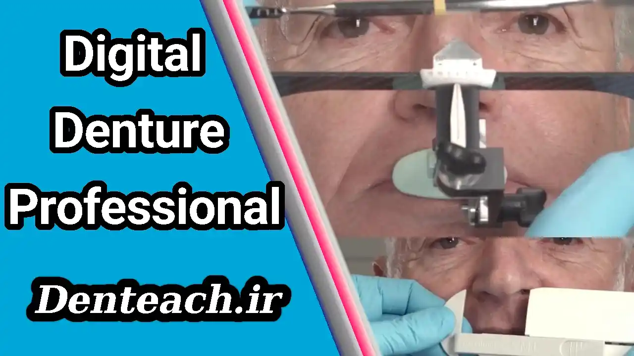 The Future of Dentures: Digital Techniques for Superior Comfort and Design