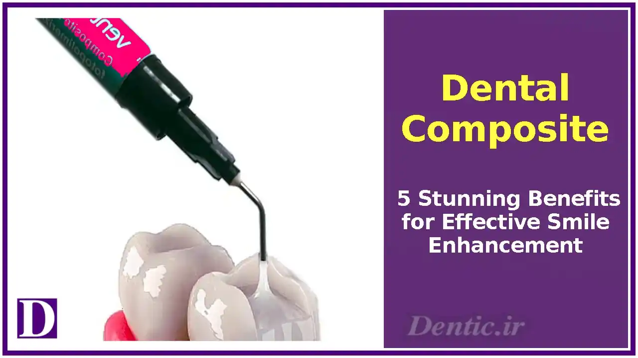 Dental Composite
